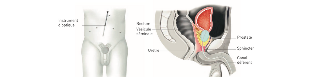 La prostate : comprendre son rôle, ses maladies et les traitements possibles